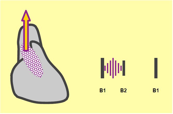 Fig11 111 en