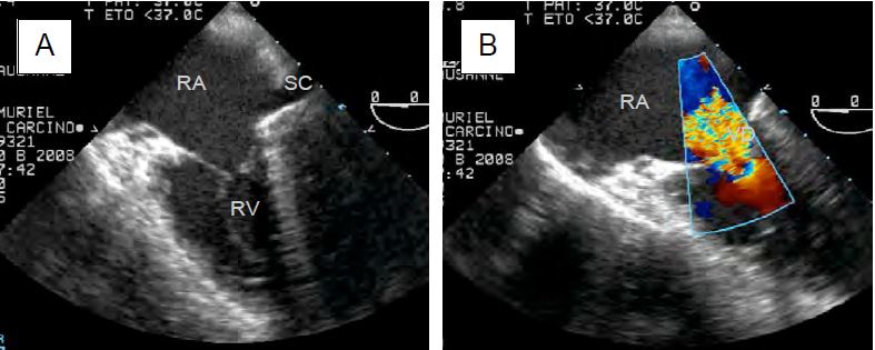 Fig11 160AB en