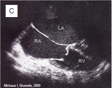 Fig11 160C en