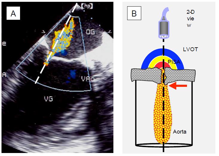 Fig11 25 en