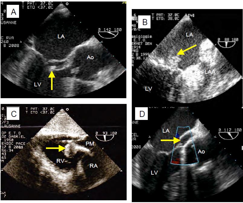 Fig11 32 en