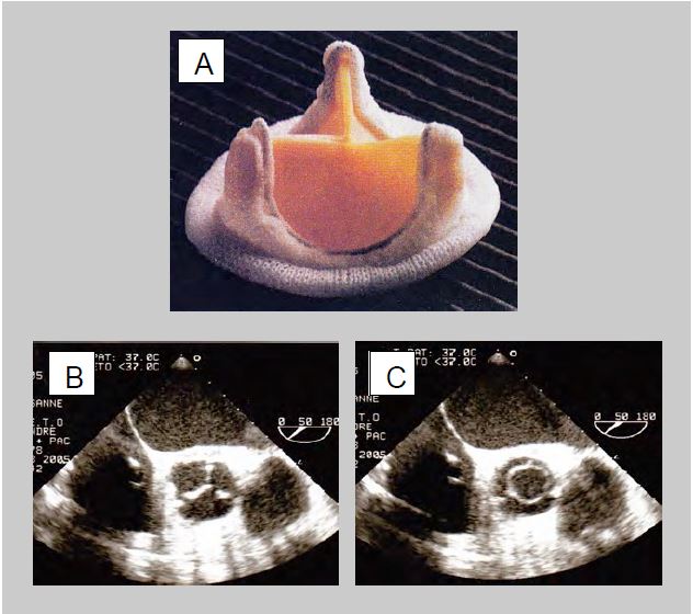 Fig11 38 en