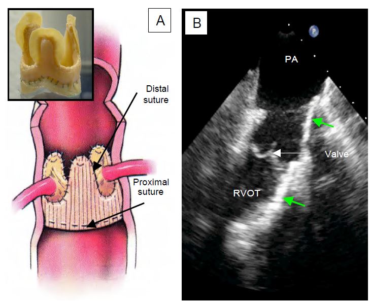 Fig11 39 en