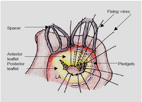 Fig11 41 en