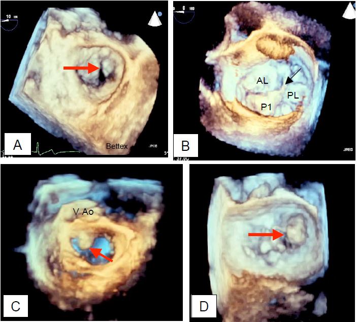 Fig11 74 en