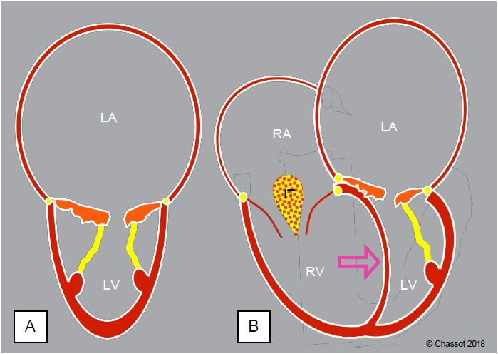 Fig11 86 en