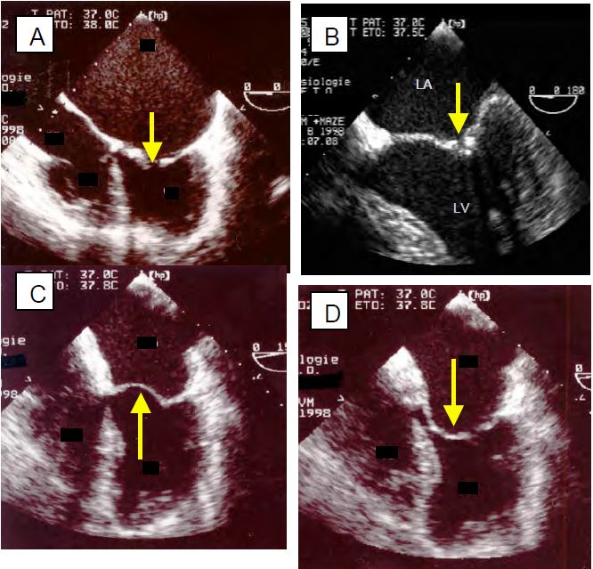 Fig11 87 en