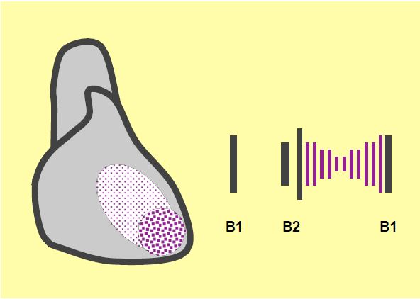 Fig11 91 en