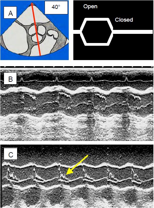 Fig13 13en