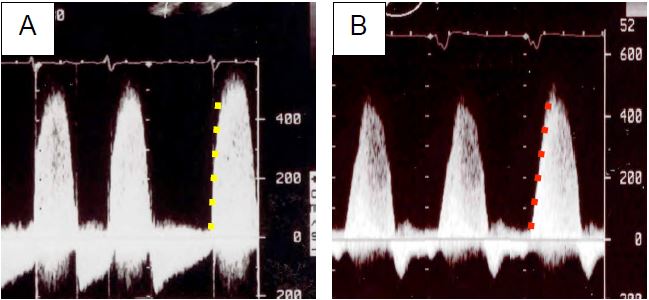 Fig26 19en