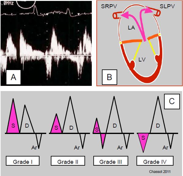 Fig26 35en